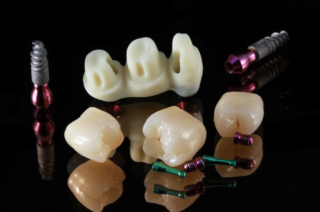 Протезирование зубов в спб