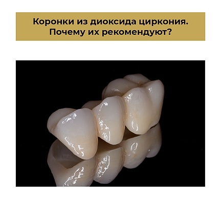 Коронки из диоксида циркония